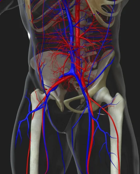pelvic venous congestion treatment