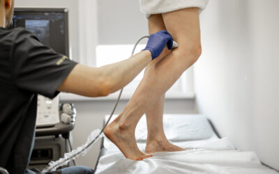 What Happens If May-Thurner Syndrome Goes Untreated?